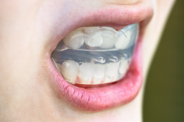 マイオブレースで矯正をする様子