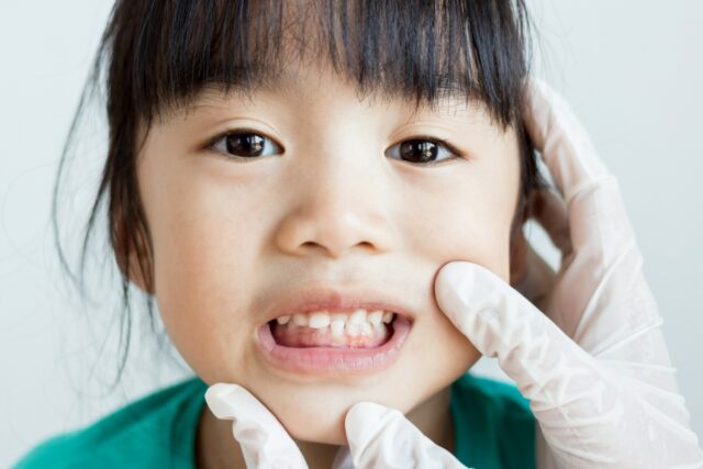 MFT治療中の子ども