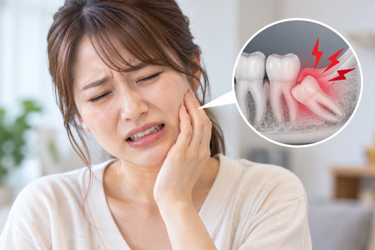 親知らずを放置して痛みが出てきた様子