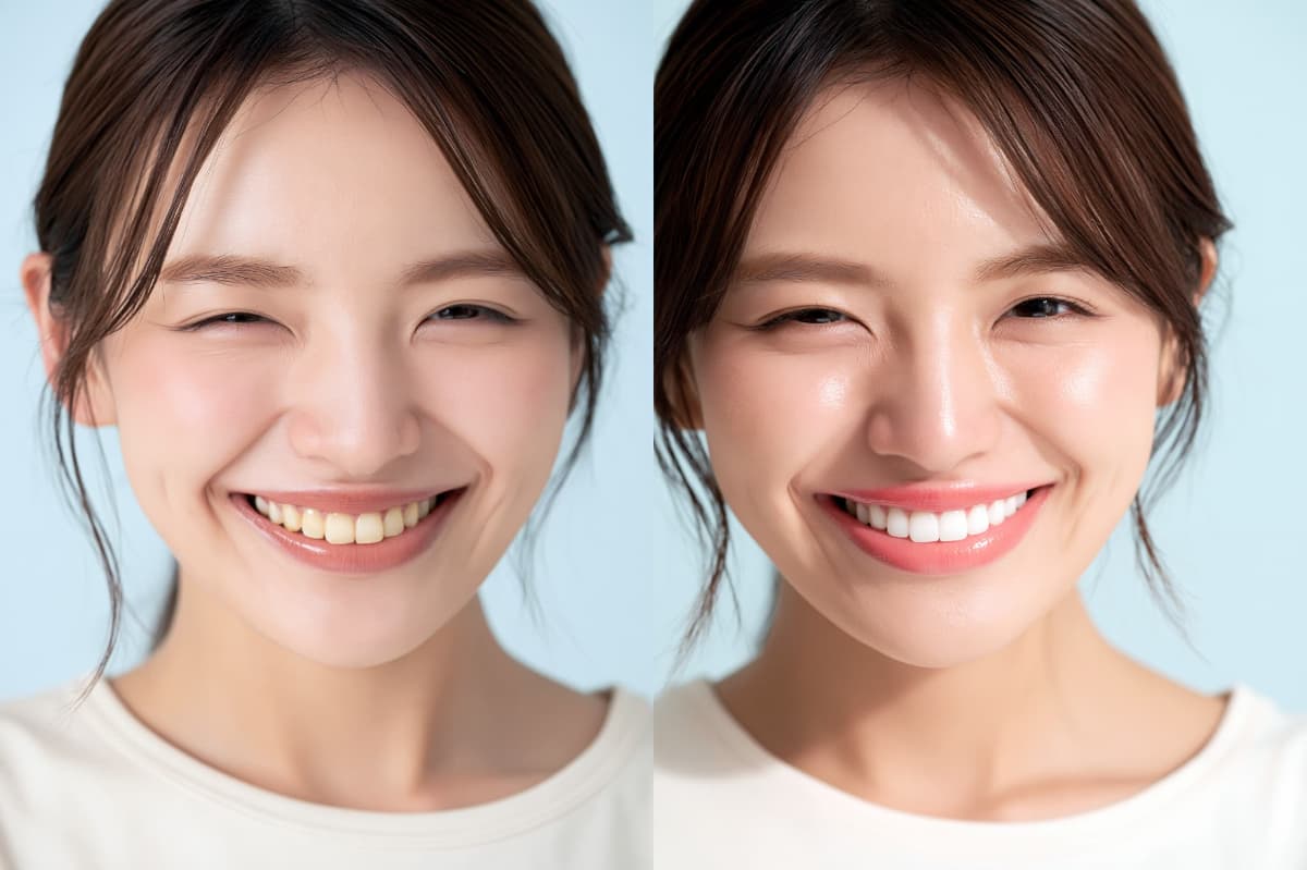 ホワイトニングを受けた女性のビフォーアフター